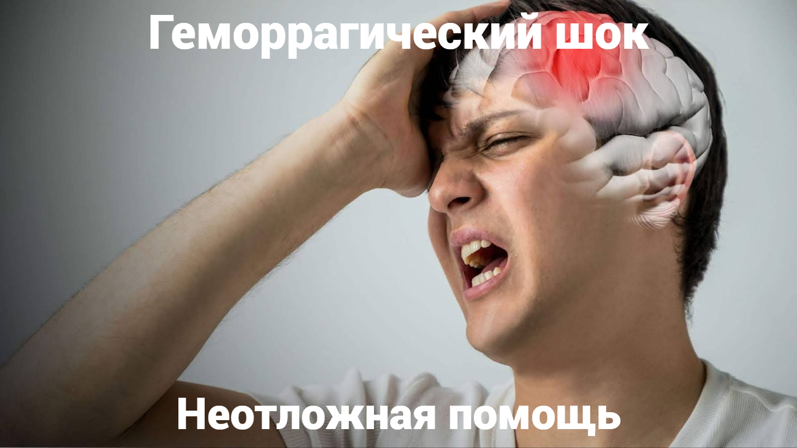 Геморрагический шок: неотложная помощь