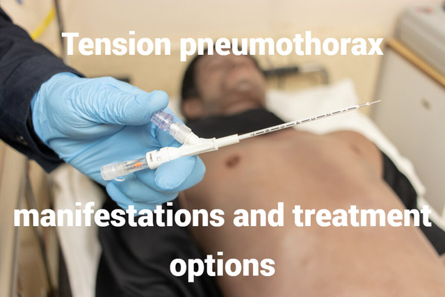Tension pneumothorax: manifestations and treatment options