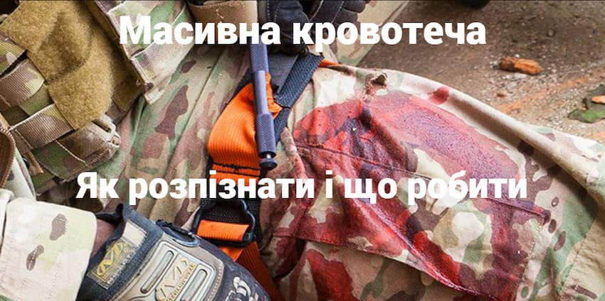 Масивна кровотеча: як розпізнати і що робити