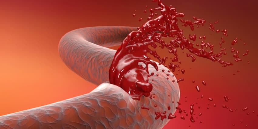First aid for internal bleeding