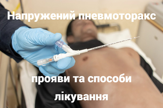 Напружений пневмоторакс: прояви та способи лікування
