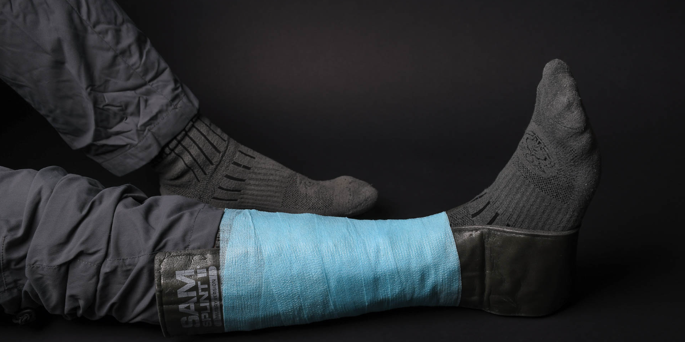 Medical splint for immobilisation: types, purpose and rules of use