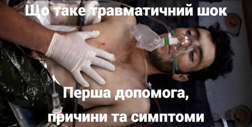 Що таке травматичний шок: перша допомога, причини та симптоми