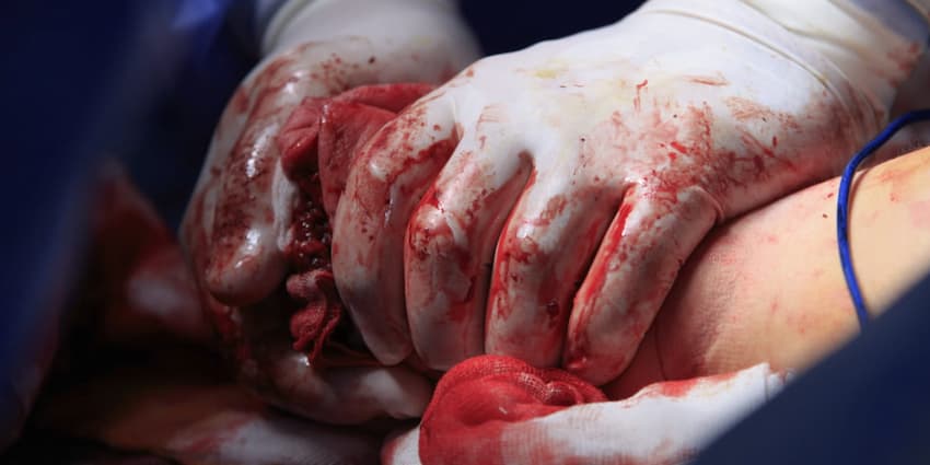 First aid for arterial bleeding