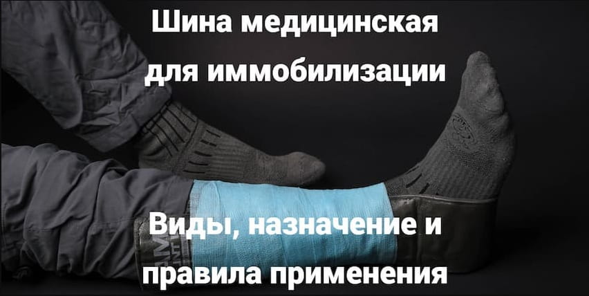Шина медицинская для иммобилизации: виды, назначение и правила применения